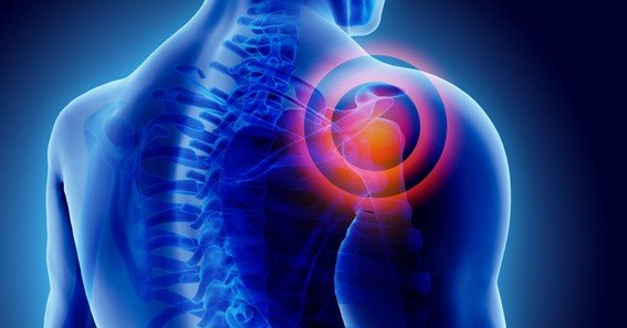 How To Know That Your Shoulder Pain From A Car Accident Is severe