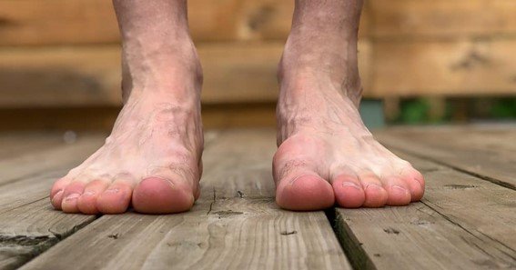 How to Remove Bone Spur on Top of the Foot Cosmetically